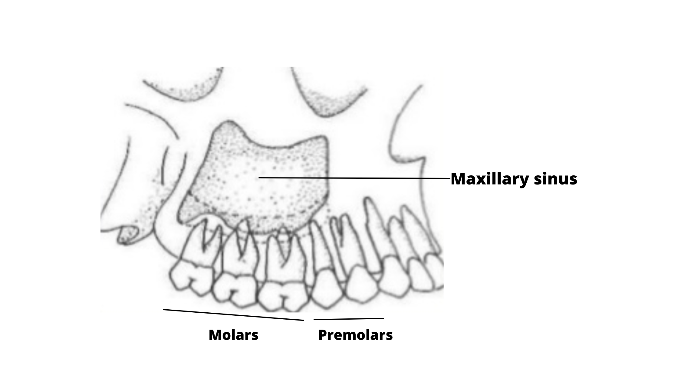 maxillary sinus and underlying teeth