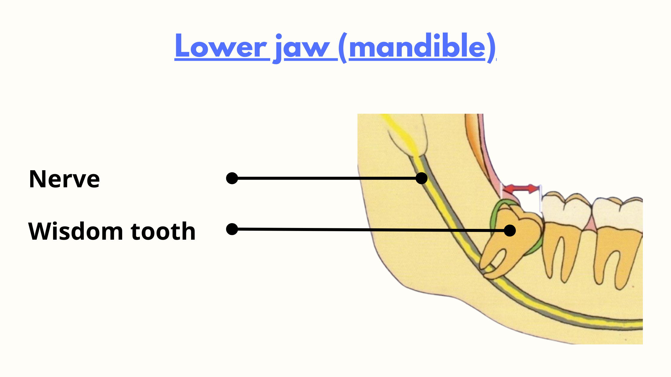 lower wisdom teeth carry a higher risk of nerve damage during the extraction procedure