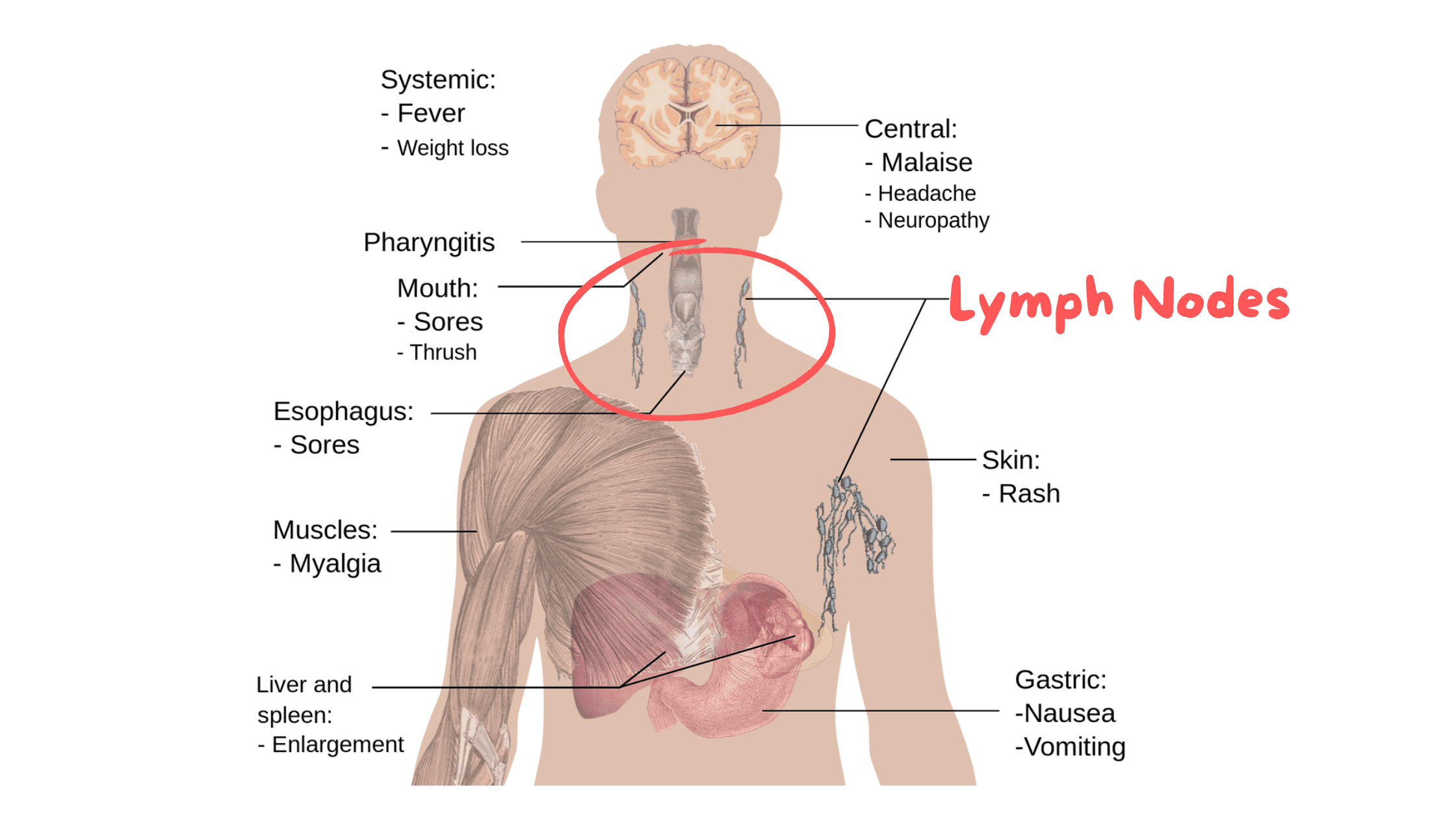 lymph nodes of the neck