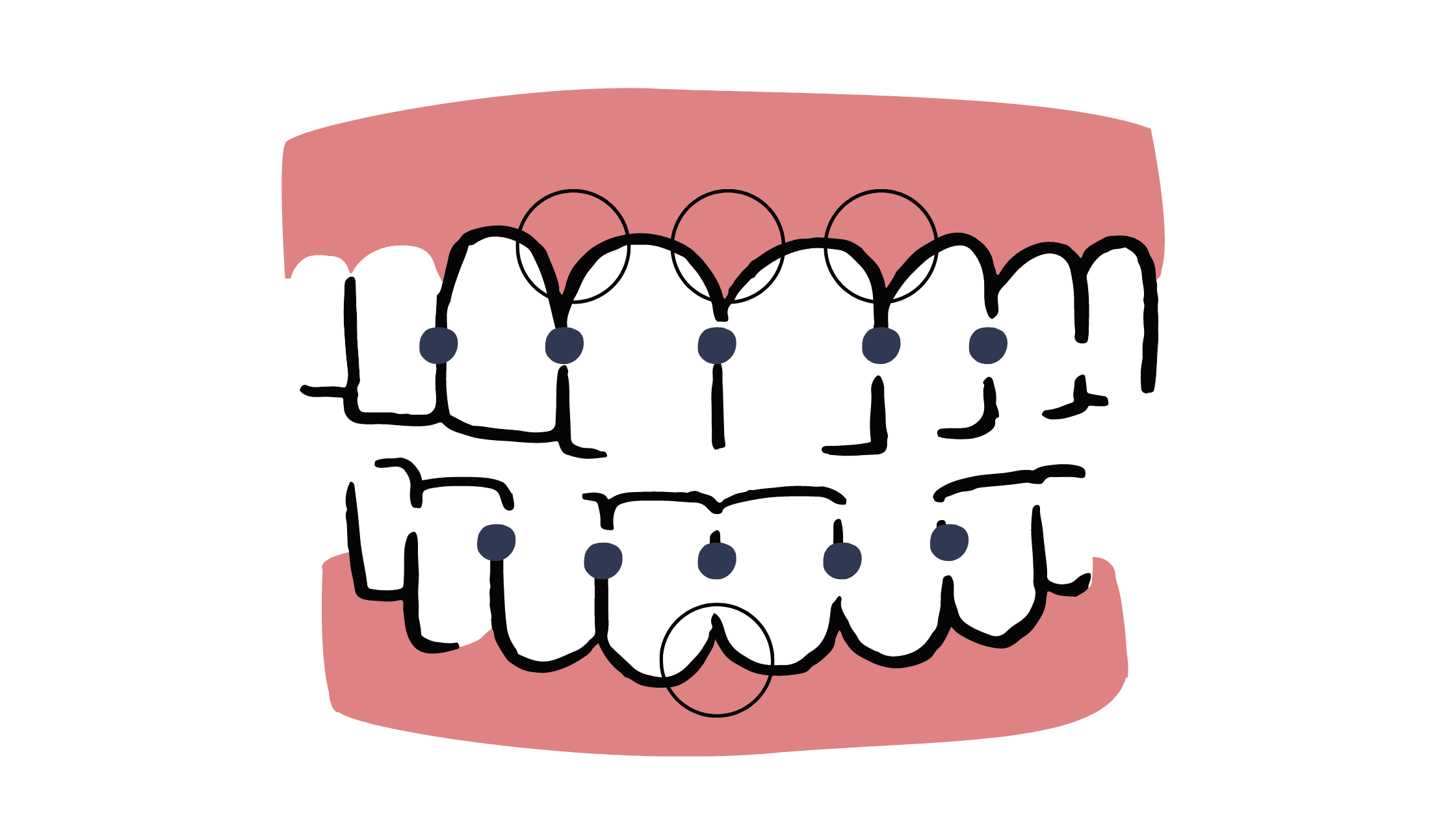 The area between teeth
